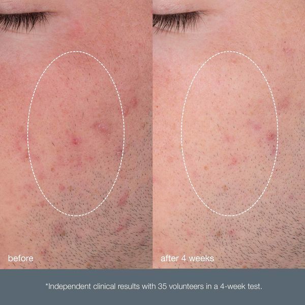 Dermalogica Daily Microfoliant - Щоденний мікрофоліант, 40 г 811249 фото