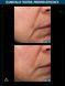 Allies of Skin Мультипептидна сироватка з ефектом ліфтингу Multi Peptides & GF Advanced Lifting Serum PMPLS030EN01 фото 3