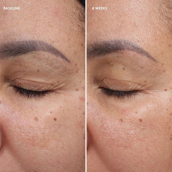 Colorescience Total Eye&reg; Firm & Repair Cream | Крем для зволоження зони навколо очей 403504100 фото